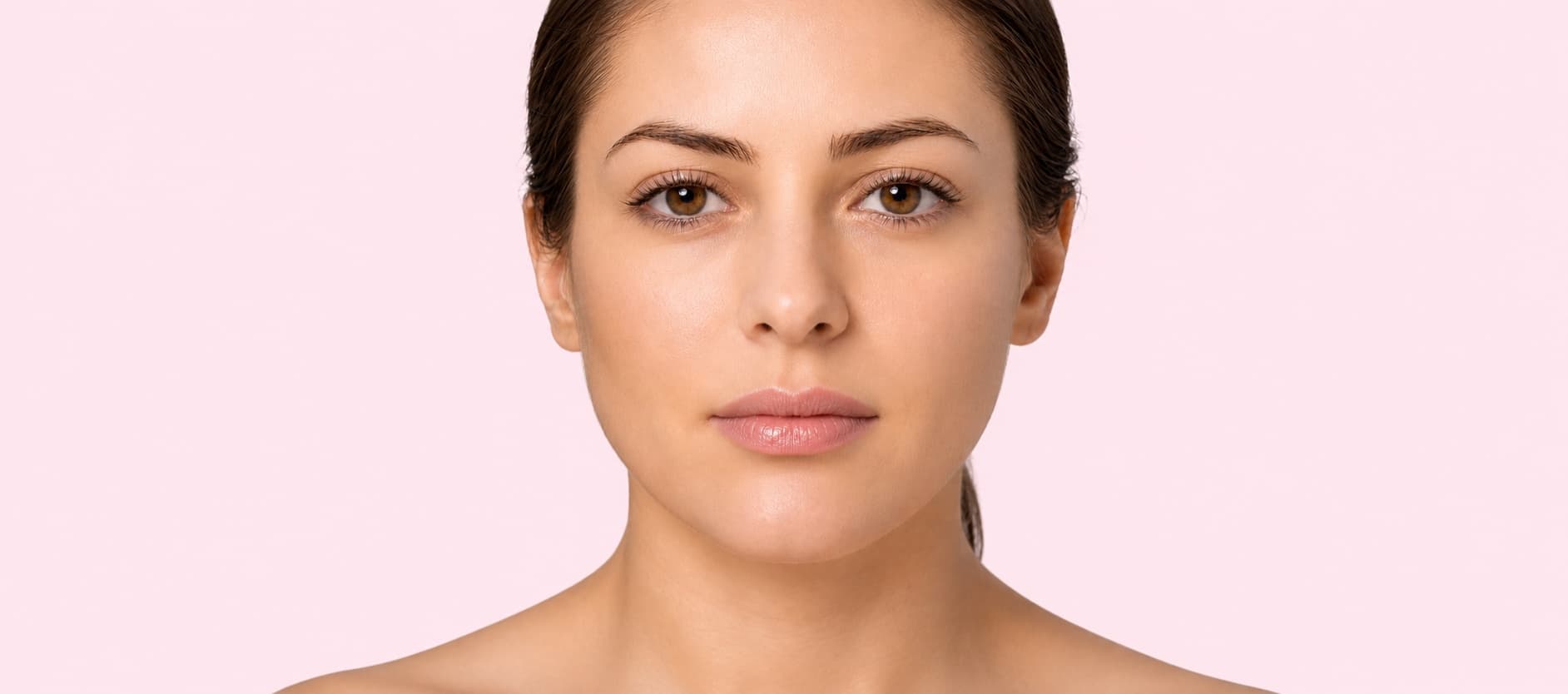 Client lips after treatment